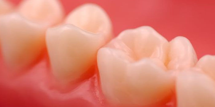 オールジルコニアクラウン