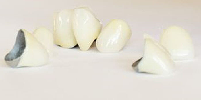 ハイブリッドセラミッククラウン