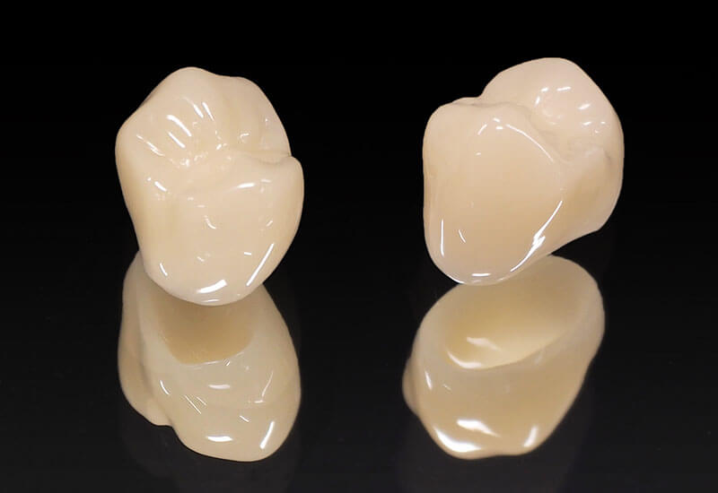 セラミック治療