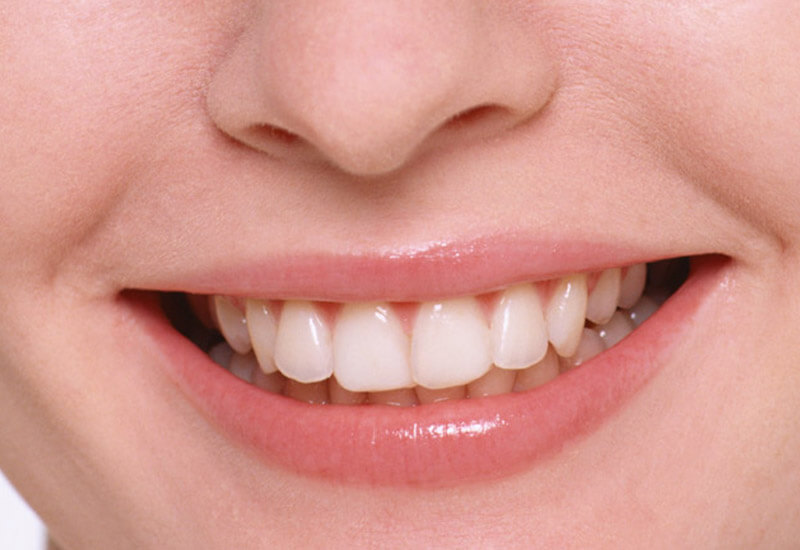 経年劣化の心配が少ない