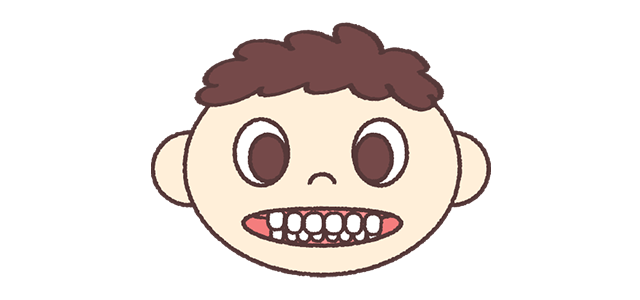 過蓋咬合 （かがいこうごう）