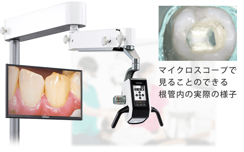 マイクロスコープ