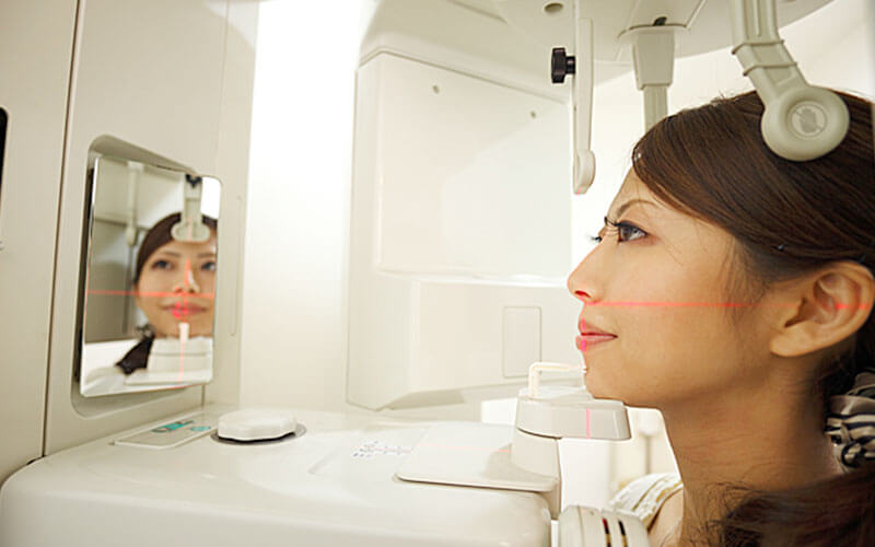 歯科用CTスキャナー