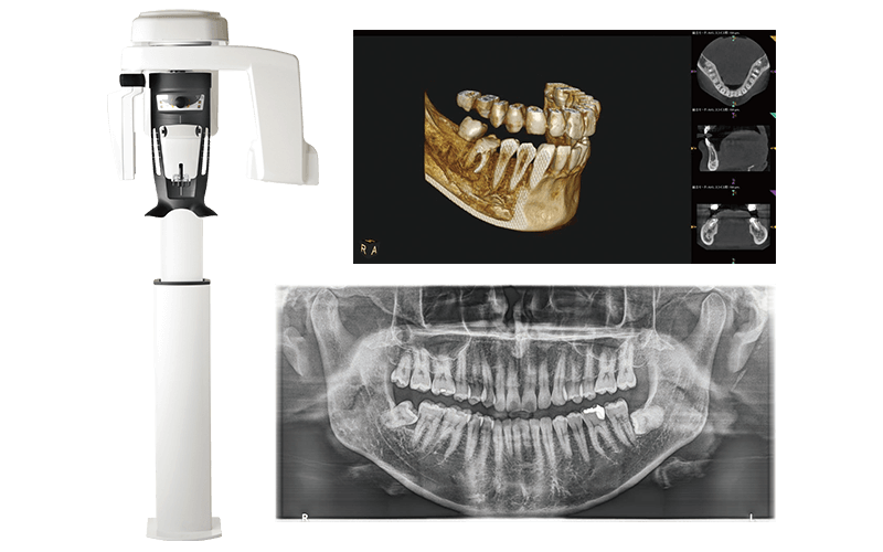 デジタルマイクロスコープ