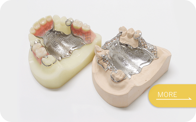 入れ歯（義歯）