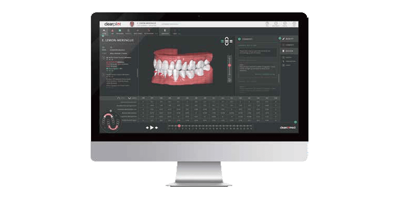 治療計画の作成