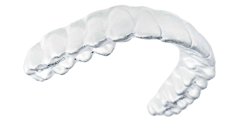 アライナーを製作