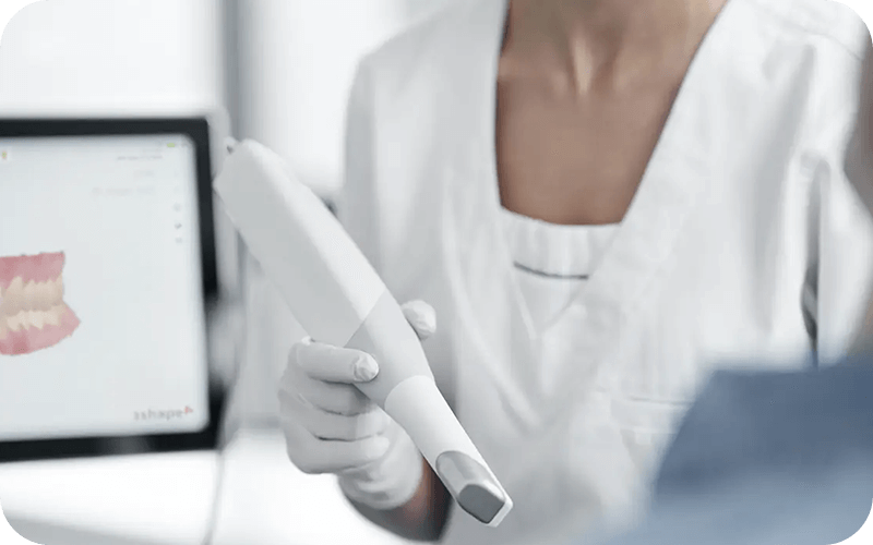 非常にスピーディー