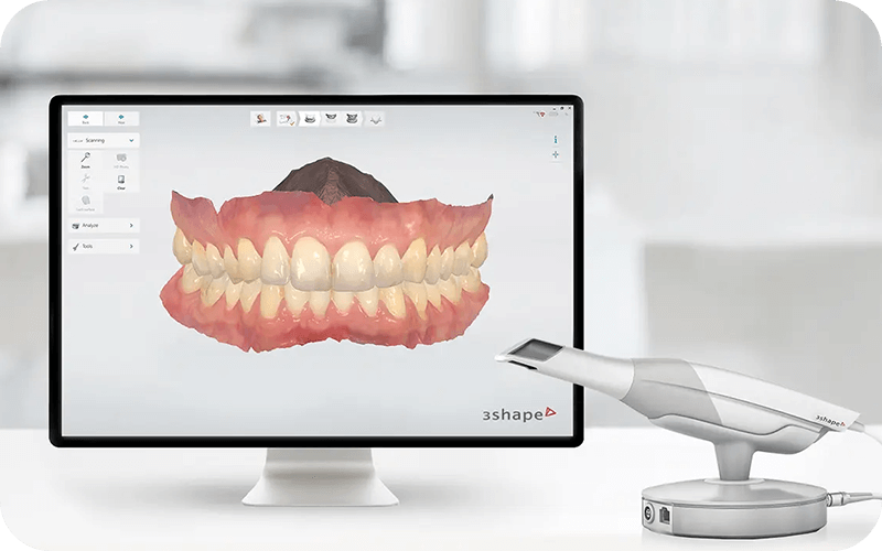 超精密で採り直しリスクゼロ
