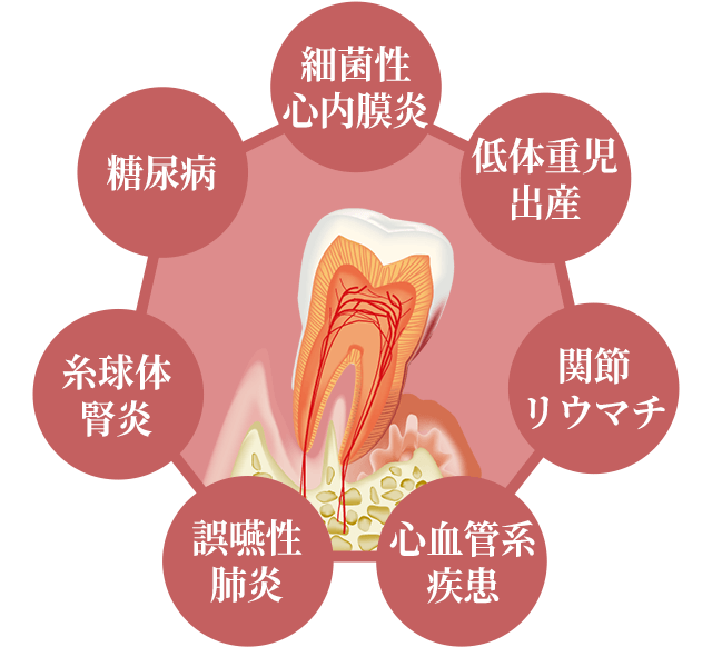 歯周病と全身疾患