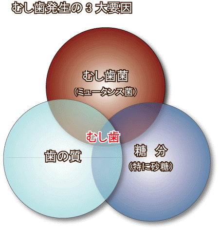むし歯の3大要因
