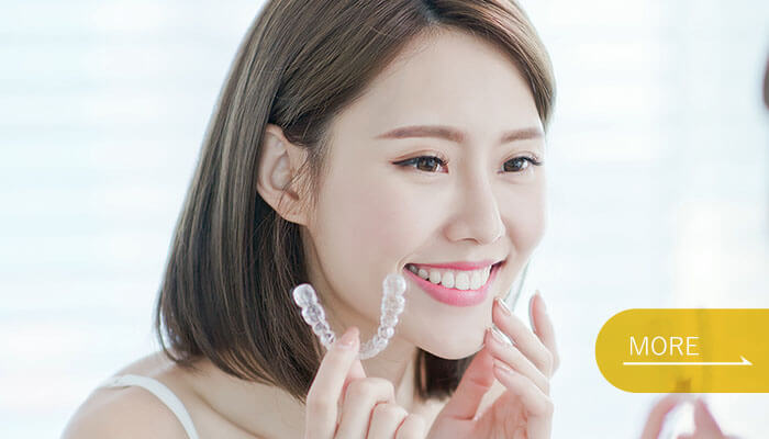 マウスピース矯正