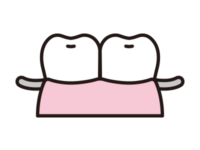 入れ歯（義歯）