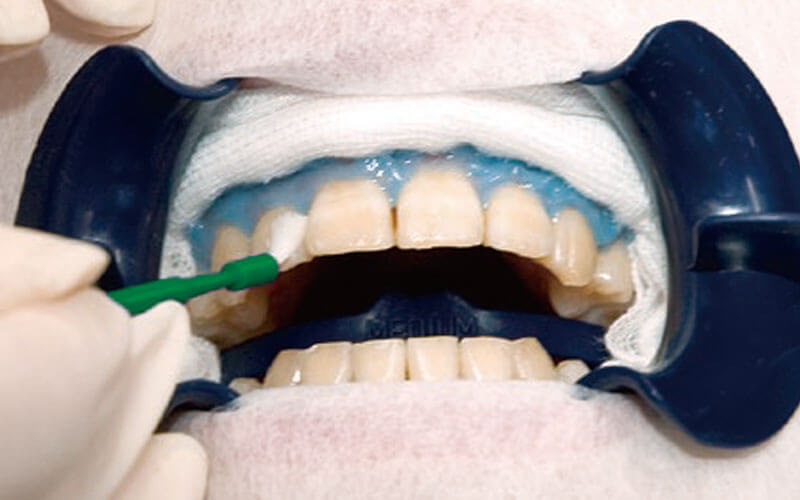 リアクター塗布