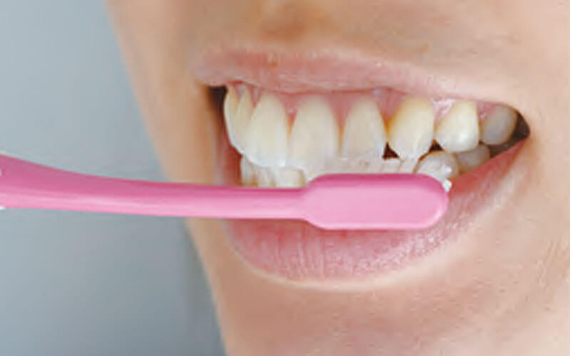 ホワイトニング前のブラッシング