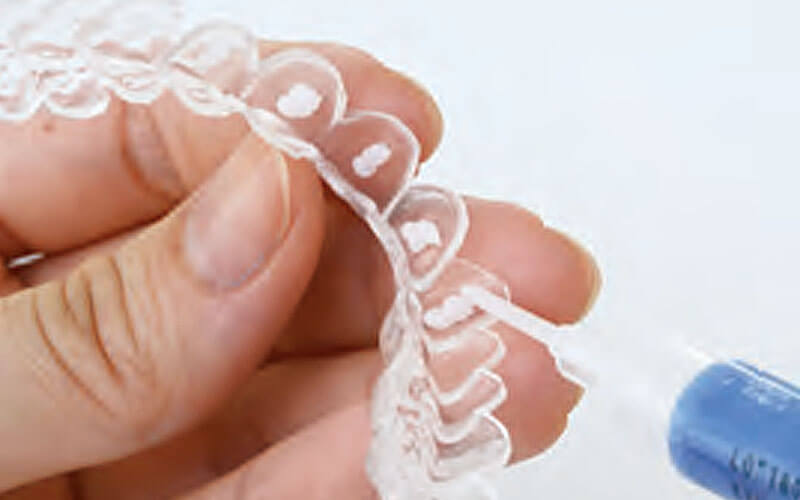 ホワイトニングジェルの注入