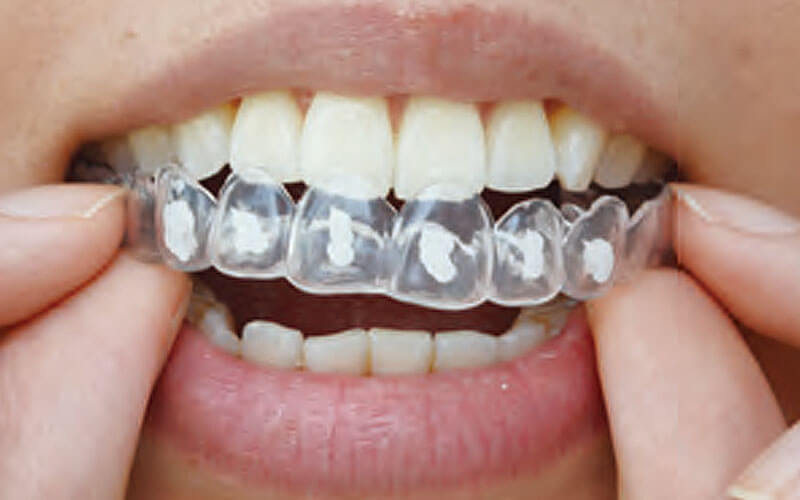 マウストレーの装着