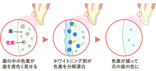 ホワイトニングのメカニズム