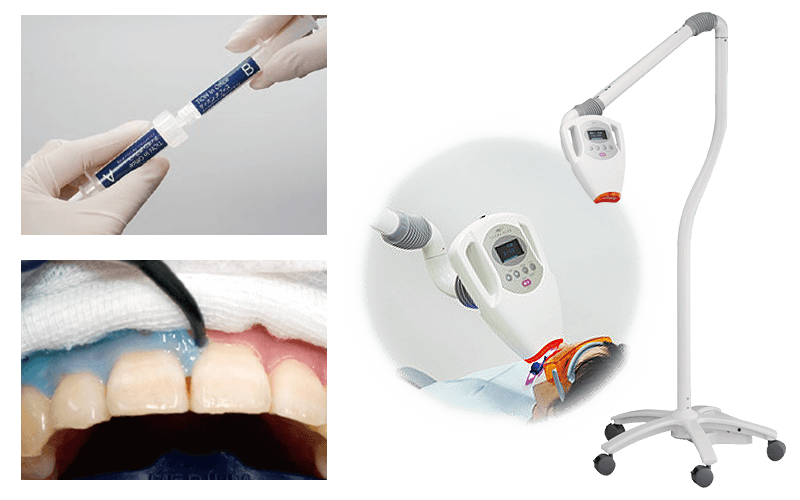 オフィスホワイトニング